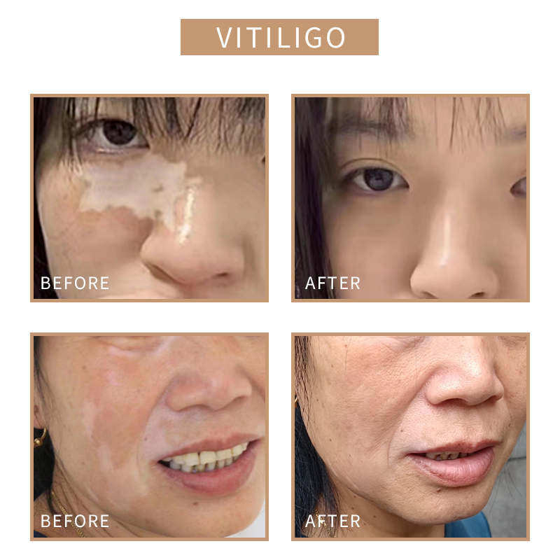 SOBER SKIN Tattoo Ink for Skin - Beauty Mark Makeup ulasan dan harga